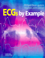 Ecgs by Example