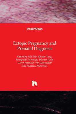 Ectopic Pregnancy and Prenatal Diagnosis - Wu, Wei (Editor), and Tang, Qiuqin (Editor), and Tsikouras, Panagiotis (Editor)