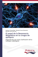 El Papel de La Resonancia Magnetica En La Cirugia de Epilepsia