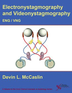 Electronystagmography/Videonystagmography: (ENG/VNG)