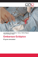 Embarazo Ectopico