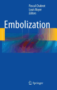 Embolization