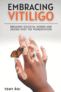 Embracing Vitiligo: Breaking Societal Norms and Seeing Past the Pigmentation: Finding self-confidence with vitiligo & 100 affirmations for embracing the skin you're in