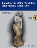 Encyclopedia of Body Sculpting After Massive Weight Loss