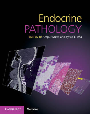 Endocrine Pathology with Online Resource - Mete, Ozgur (Editor), and Asa, Sylvia L (Editor)