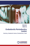 Endodontic-Periodontics Lesion