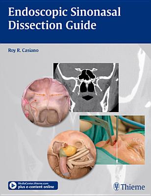 Endoscopic Sinonasal Dissection Guide - Casiano, Roy R