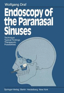 Endoscopy of the Paranasal Sinuses: Technique . Typical Findings Therapeutic Possibilities