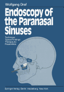 Endoscopy of the Paranasal Sinuses: Technique - Typical Findings Therapeutic Possibilities