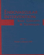 Endovascular Intervention: Basic Concepts and Techniques