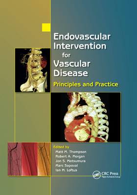 Endovascular Intervention for Vascular Disease: Principles and Practice - Thompson, Matt M. (Editor), and Morgan, Robert A. (Editor), and Matsumura, Jon S. (Editor)
