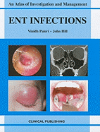 ENT Infections: An Atlas of Investigation and Management