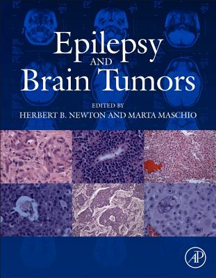 Epilepsy and Brain Tumors - Newton, Herbert B, MD (Editor), and Maschio, Marta (Editor)