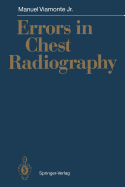 Errors in chest radiography