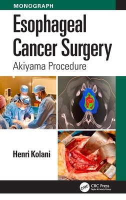 Esophageal Cancer Surgery: Akiyama Procedure - Kolani, Henri