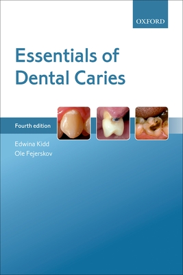Essentials of Dental Caries - Kidd, Edwina, and Fejerskov, Ole