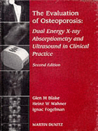 Evaluation of Osteoporosis - Blake, Glen M (Editor), and Wahner, Heinz W (Editor), and Fogelman, Ignac (Editor)