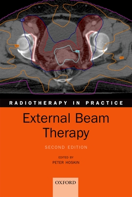 External Beam Therapy - Hoskin, Peter (Editor)