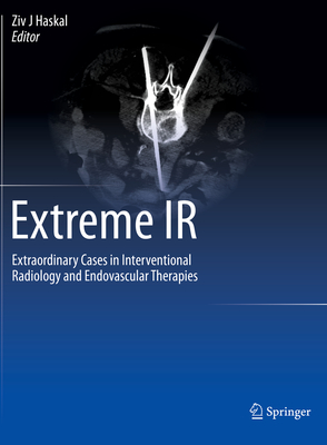 Extreme IR: Extraordinary Cases in Interventional Radiology and Endovascular Therapies - Haskal, Ziv J (Editor)