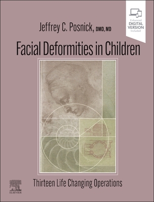 Facial Deformities in Children: Thirteen Life Changing Operations - Posnick, Jeffrey C, DMD, MD, Facs