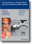 Facial Nerve in Temporal Bone and Lateral Skull Base Microsurgery