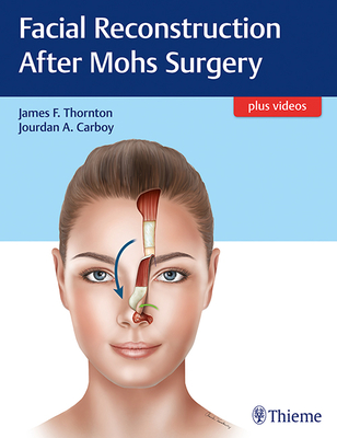 Facial Reconstruction After Mohs Surgery - Thornton, James, Rev. (Editor), and Carboy, Jourdan (Editor)