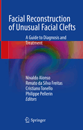 Facial Reconstruction of Unusual Facial Clefts: A Guide to Diagnosis and Treatment