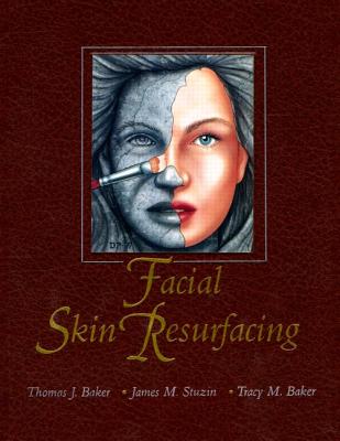 Facial Skin Resurfacing - Baker, Thomas J, and Stuzin, James, and Baker, Tracy