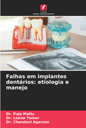 Falhas em implantes dentrios: etiologia e manejo