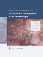 Fallstricke Und Fehlerquellen in Der Dermatologie - Khn, Frank-Michael (Editor), and Ring, Johannes (Editor)