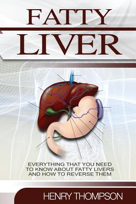 Fatty Liver: The Ultimate Step-By-Step Guide to Understanding and Reversing Fatty Liver Disease (Liver Cleanse, Nutrition, Liver Cleanse, Healthy Living, Revitalise Health, Detox Body, Weight) - Thompson, Henry