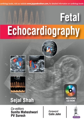 Fetal Echocardiography - Shah, Sejal, and Maheshwari, Sunita, and "Suresh"