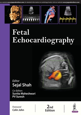 Fetal Echocardiography - Shah, Sejal, and Maheshwari, Sunita, and Suresh, PV