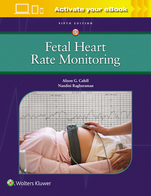 Fetal Heart Rate Monitoring - Cahill, Alison, and Raghuraman, Nandini