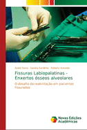Fissuras Labiopalatinas - Enxertos sseos alveolares