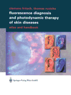 Fluorescence Diagnosis and Photodynamic Therapy of Skin Diseases: Atlas and Handbook