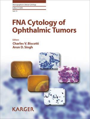 FNA Cytology of Ophthalmic Tumors - Biscotti, C.V. (Editor), and Singh, A.D. (Editor), and Vielh, Philippe (Series edited by)