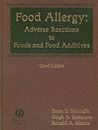 Food Allergy: Adverse Reactions to Food and Food Additives - Metcalfe, Dean D, and Hong-Shum, Lily, and Simon, Ronald A