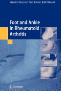 Foot and Ankle in Rheumatoid Arthritis