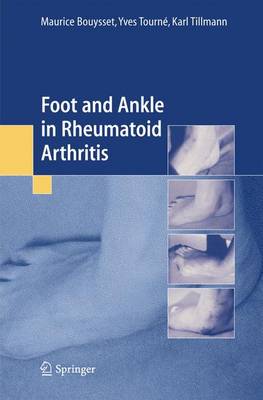 Foot and Ankle in Rheumatoid Arthritis - Bouysset, Maurice, and Tourne, Yves, and Tillmann, Karl