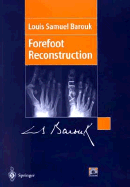 Forefoot Reconstruction