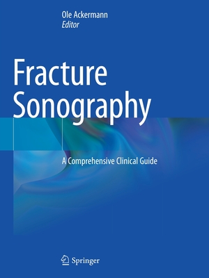 Fracture Sonography: A Comprehensive Clinical Guide - Ackermann, Ole (Editor)