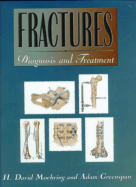 Fractures: Diagnosis and Treatment