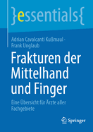 Frakturen Der Mittelhand Und Finger: Eine bersicht Fr rzte Aller Fachgebiete
