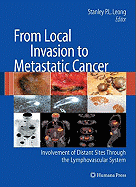 From Local Invasion to Metastatic Cancer: Involvement of Distant Sites Through the Lymphovascular System