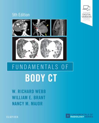 Fundamentals of Body CT - Webb, W Richard, MD, and Brant, Wiliam E., and Major, Nancy M.