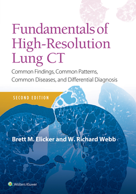 Fundamentals of High-Resolution Lung CT: Common Findings, Common Patterns, Common Diseases and Differential Diagnosis - Elicker, Brett M, MD, and Webb, W Richard