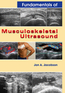 Fundamentals of Musculoskeletal Ultrasound: Expert Consult- Online and Print - Jacobson, Jon A