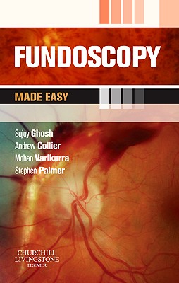 Fundoscopy Made Easy - Ghosh, Sujoy, and Collier, Andrew, BSC, MD, and Varikkara, Mohan, MS, Frcs