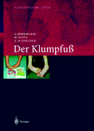 Fussdeformitaten: Der Klumpfua. Erscheinungsformen Und Behandlungsprinzipien Jeden Alters. Differentialdiagnose Und Differentialtherapie